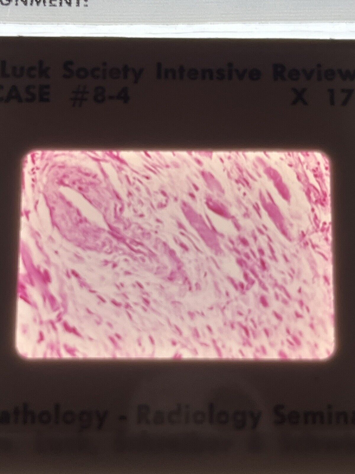 5276382